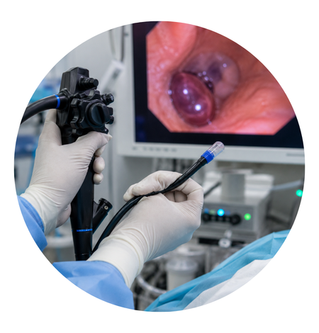 Therapeutic Endoscopy -Endoscopic Variceal Banding